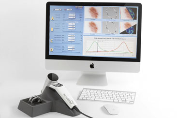 Bilder einer digitalen Dermatoskopie auf dem Monitor