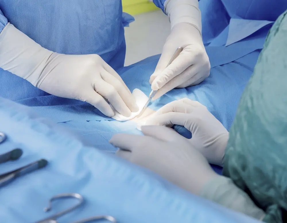 Hautzentrum Kurpark Ambulante Operationen Ärzte nehmen einen kleinen, operativen Eingriff an der Haut eines Patienten vor