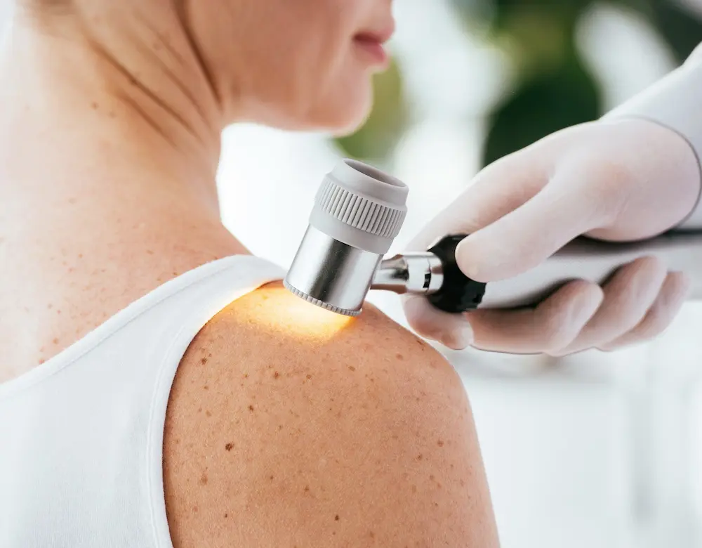 Eine Frau lässt ihre Schulter, die viele Sommersprossen hat, dermatologisch untersuchen